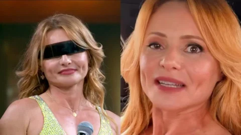 Rita Guedes diz que quase perdeu a visão após blefaroplastia; atriz relata ceratite, quemose e paralisia temporária da pálpebra